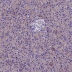 Anti-SPTLC3 Antibody