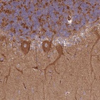 Anti-SNRNP25 Antibody