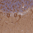 Anti-SNRNP25 Antibody