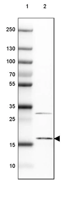 Lane 1: Marker [kDa] 250, 130, 100, 70, 55, 35, 25, 15, 10_br/_Lane 2: Human cell line MCF-7