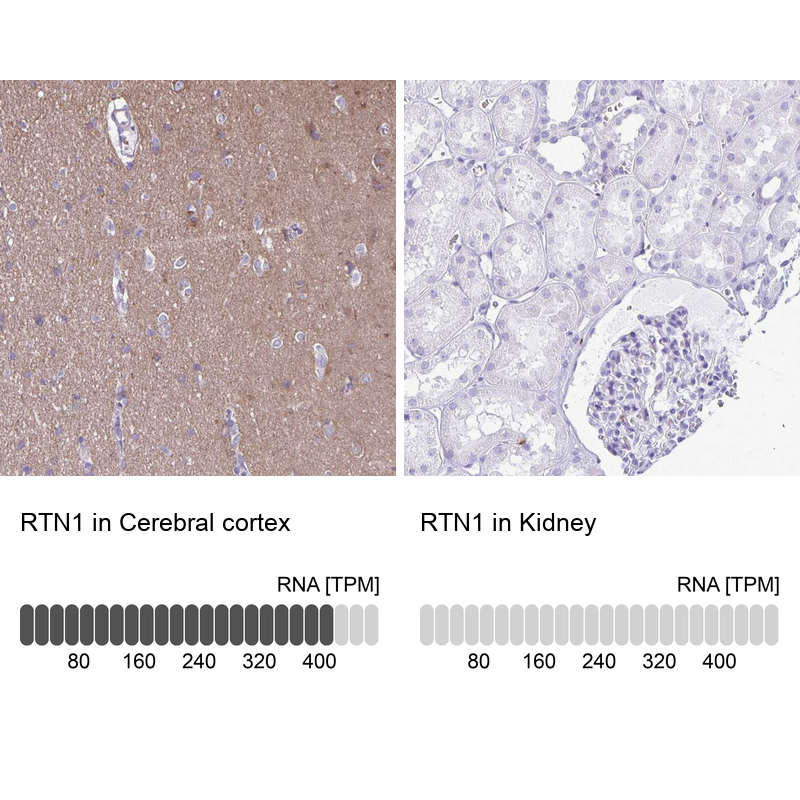 Anti-RTN1 Antibody