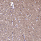 Immunohistochemical staining of human cerebral cortex shows moderate to strong positivity in neurons.