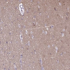 Immunohistochemical staining of human cerebral cortex shows moderate to strong positivity in neurons.