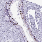 Immunohistochemical staining of human cervix, uterine shows moderate to strong cytoplasmic positivity in glandular cells.