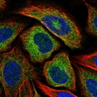 Immunofluorescent staining of human cell line SiHa shows localization to endoplasmic reticulum.
