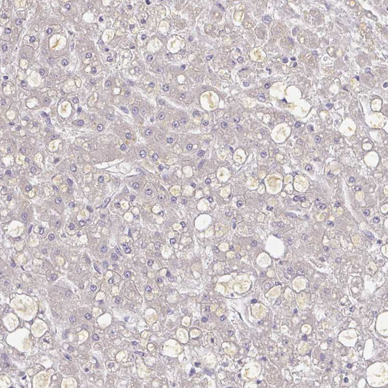 Anti-A1BG Antibody