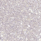 Anti-A1BG Antibody