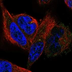 Immunofluorescent staining of human cell line RH-30 shows localization to microtubule organizing center.