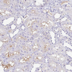 Anti-A1BG Antibody