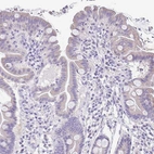 Immunohistochemical staining of human Small intestine shows weak cytoplasmic positivity in glandular cells.