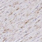 Immunohistochemical staining of human Heart muscle shows moderate cytoplasmic positivity in cardiomyocytes.