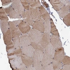 Immunohistochemical staining of human skeletal muscle shows moderate cytoplasmic and nuclear positivity in myocytes.