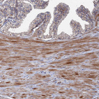 Immunohistochemical staining of human prostate shows moderate cytoplasmic positivity in smooth muscle cells.