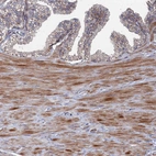 Immunohistochemical staining of human prostate shows moderate cytoplasmic positivity in smooth muscle cells.