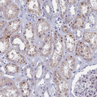 Immunohistochemical staining of human kidney shows weak cytoplasmic positivity in cells in tubules.