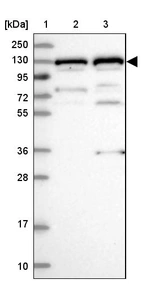 Lane 1: Marker [kDa] 250, 130, 95, 72, 55, 36, 28, 17, 10_br/_Lane 2: Human cell line RT-4_br/_Lane 3: Human cell line U-251MG sp