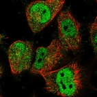 Immunofluorescent staining of human cell line U-251 MG shows localization to nucleoplasm & cytosol.