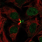 Immunofluorescent staining of human cell line CACO-2 shows localization to nucleoplasm & midbody.