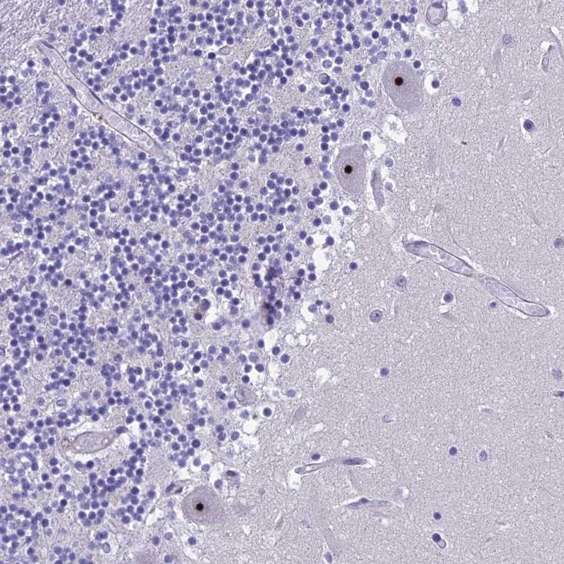 Anti-NOC2L Antibody
