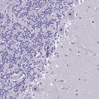 Anti-NOC2L Antibody