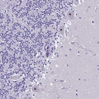 Anti-NOC2L Antibody