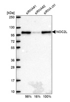 Western blot analysis in U2OS cells transfected with control siRNA, target specific siRNA probe #1 and #2, using Anti-NOC2L antibody. Remaining relative intensity is presented.