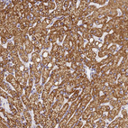Immunohistochemical staining of human liver shows strong cytoplasmic granular positivity in hepatocytes.