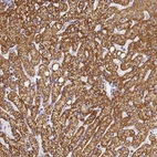 Immunohistochemical staining of human liver shows strong cytoplasmic granular positivity in hepatocytes.