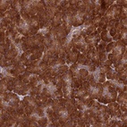 Anti-DHCR7 Antibody