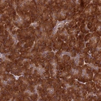 Anti-DHCR7 Antibody