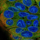 Immunofluorescent staining of human cell line CACO-2 shows localization to endoplasmic reticulum.