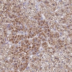 Anti-SDR39U1 Antibody