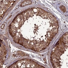 Immunohistochemical staining of human testis shows strong cytoplasmic positivity in cells in seminiferous ducts and leydig cells.