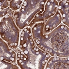 Immunohistochemical staining of human small intestine shows strong cytoplasmic positivity in glandular cells.