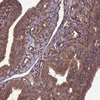 Immunohistochemical staining of human fallopian tube shows moderate cytoplasmic positivity in glandular cells.