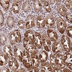 Anti-TP53AIP1 Antibody