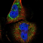 Immunofluorescent staining of human cell line U-251 MG shows localization to cytosol.