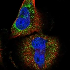 Immunofluorescent staining of human cell line U-251 MG shows localization to cytosol.