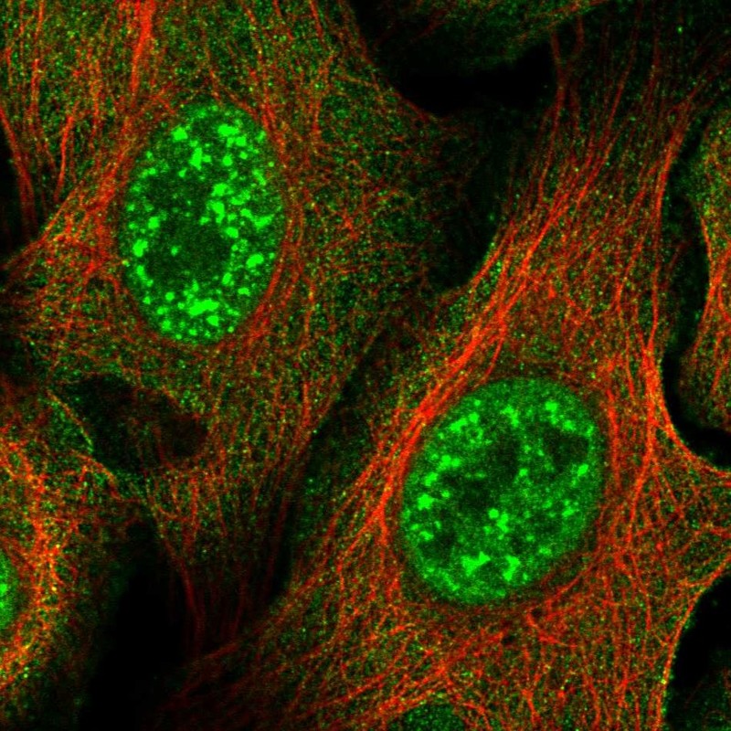 Anti-ZNF337 Antibody