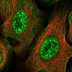 Anti-ZNF337 Antibody