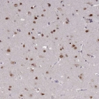 Immunohistochemical staining of human cerebral cortex shows strong nuclear positivity in neurons.