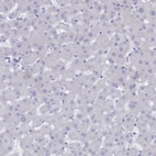 Immunohistochemical staining of human liver shows no nuclear positivity in hepatocytes.