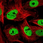 Immunofluorescent staining of human cell line U-251 MG shows localization to nucleoplasm.