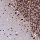 Anti-SART3 Antibody