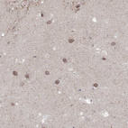 Anti-NSMF Antibody
