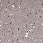Immunohistochemical staining of human cerebral cortex shows moderate nuclear membraneous positivity in neurons.