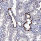 Anti-NSMF Antibody