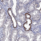 Immunohistochemical staining of human kidney shows strong membranous positivity in cells in tubules.