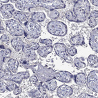 Immunohistochemical staining of human placenta shows no positivity in trophoblastic cells as expected.