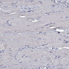 Immunohistochemical staining of human skeletal muscle shows no positivity in myocytes as expected.
